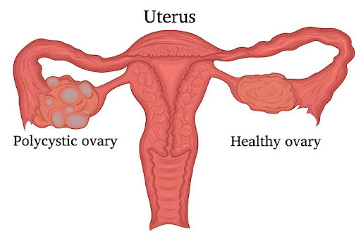 uterus